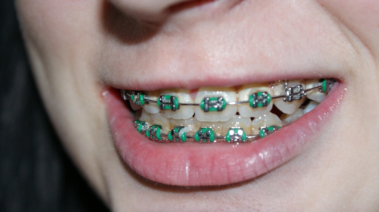tooth 366335 1280