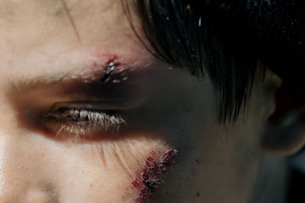 Who Is Responsible if You Are Injured on Someone Else’s Property?