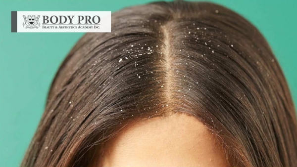 Get Rid of Dandruff with These Home Remedies